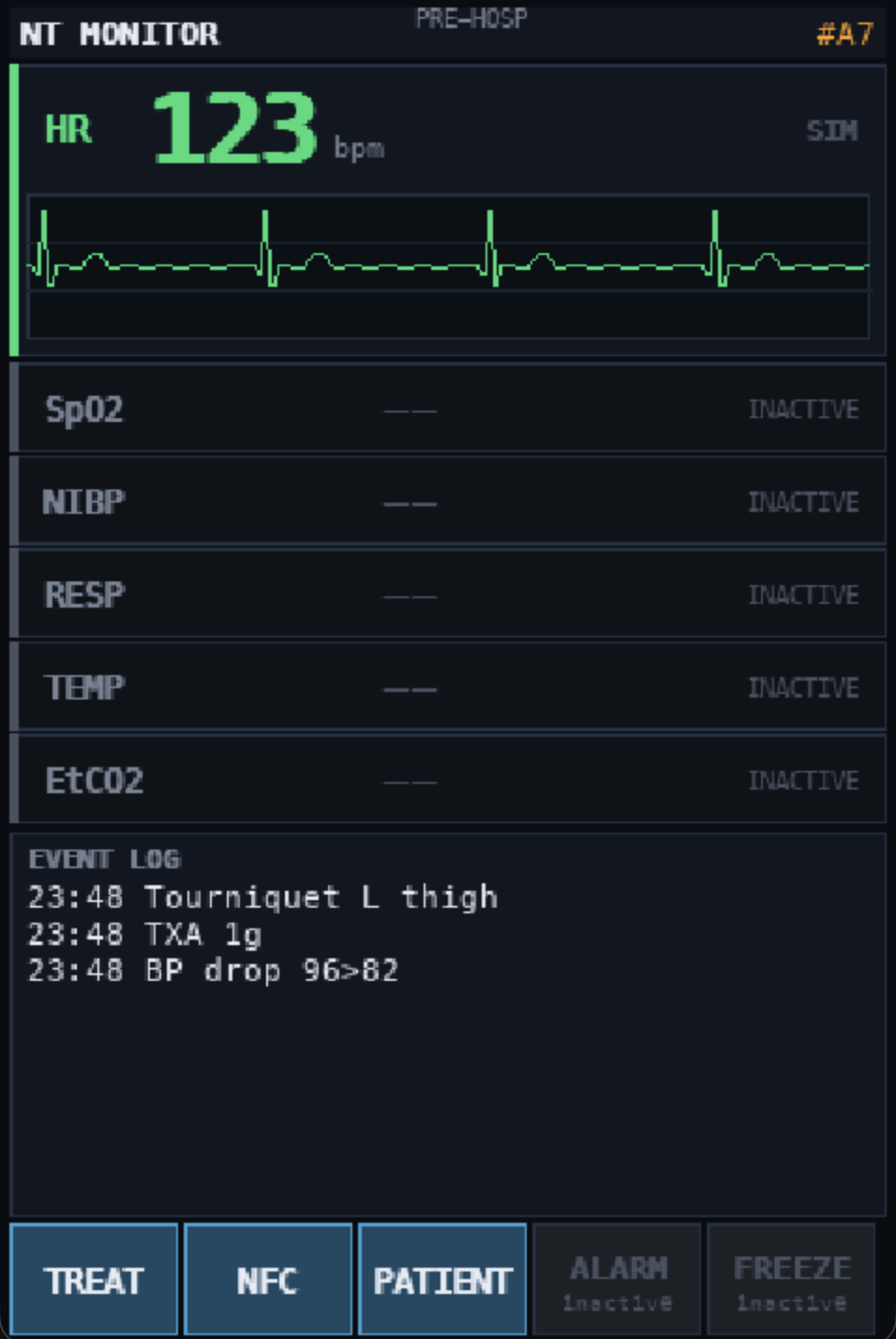 Single Synetra monitor screen showing heart rate, ECG trace, vitals and a timestamped event log